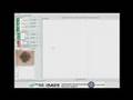 ISADS for Dermatology, an app for skin lesion exploration