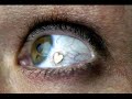 Patrick Abrial - Avis aux adultes