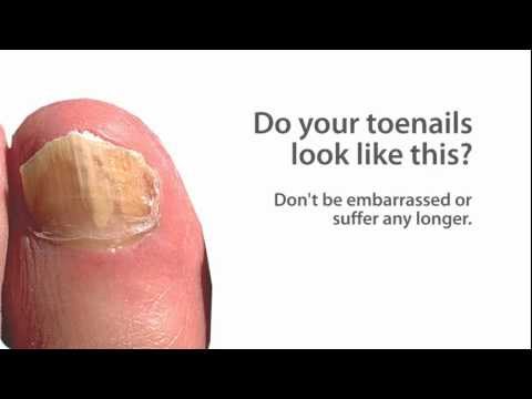 PinPointe FootLaser - Nail Fungus Treatment for Men & Women