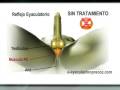 www.e-eyaculacionprecoz.com | Los ejercicios de Kegel, desarrollados por el Dr. Arnold Kegel en la década de 1940, son un punto importante a tratar para solucionar el problema de la eyaculación precoz. Esta disfunción sexual es la más común entre los hombres y hoy tiene una solución eficaz en solo 10 días, utilizando ejercicios 100% naturales y técnicas de tercera generación en lo que respecta a tratamientos para la eyaculación Precoz. E-eyaculacionprecoz.com presenta su tratamiento 3G para ...