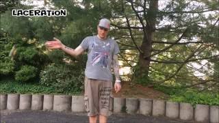 Trick: Laceration