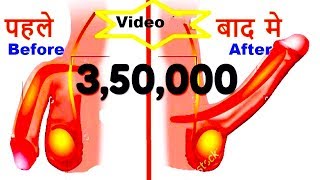 Video Search Result for mardana taqat ke liye hakimi nuskhe