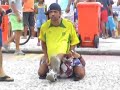 DANÇA DO ANÃO DANÇA DO ANÃO