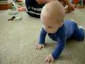 Owen Crawling after Cleft Palate Repair (spina bifida)