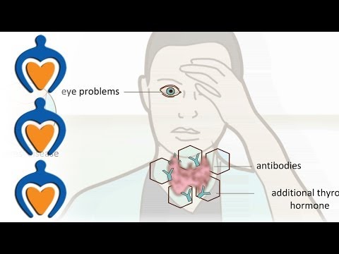 how to treat hypothyroidism
