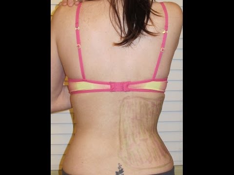 how to relieve right flank pain