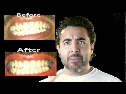 how to whiten teeth using a banana