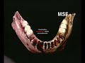 los yacimientos de la sierra de atapuerca 3ª parte