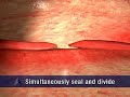 3D Medical Animation