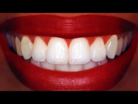 how to whiten my teeth overnight