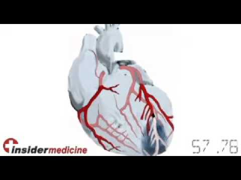 Insidermedicine in 60 - November 6, 2007