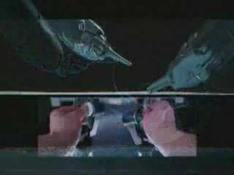 Robotic laparoscopic sacrocolpopexy ...