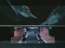Robotic laparoscopic sacrocolpopexy for vaginal vault