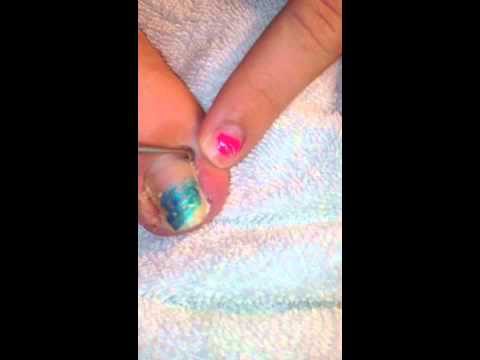 how to relieve big toenail pain