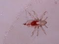 Head louse 02