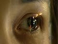 Eye doctor says LASIK is \"a terrible idea\"-CBS Katie Couric