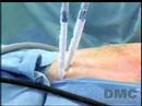 Surgery with Less Risks & Pains