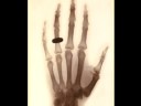 Early Science Photography: X-Rays