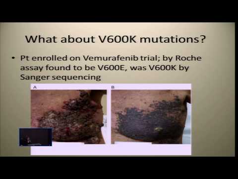 Melanoma Markers and Approach to Personalized Treatment