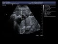 39-week ultrasound 12-27-2010