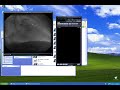 MicroDicom - free DICOM viewer