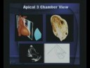 Basics Of Echocardiography Part-2(series-1) Basics Of Echocardiography Part-2(series-1)