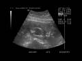 EliRod 12 30 08
