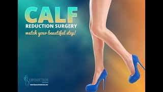 Calf reduction surgery in Korea