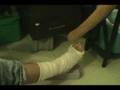 Madhava performs vibrational healing with didjeridoo....Madhava healing didjeridoo Peter Green ankle fracture feels better