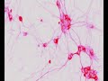 cord-blood-stem-cells-and-top-10-causes-of-death-in-us.html