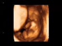 Embrion de 12 semanas
