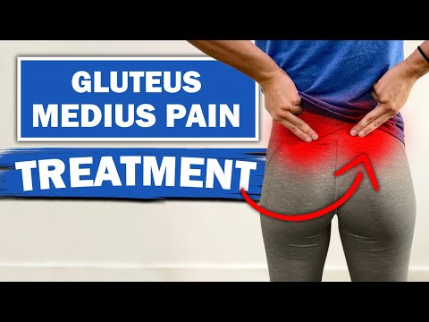 how to locate gluteus medius