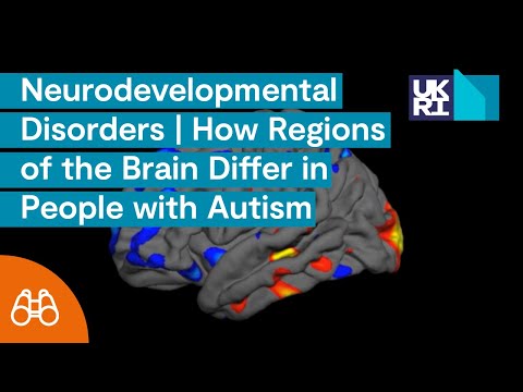 Regions of the brain known to differ in people with autism