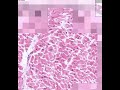Shotgun Histology Heart Endo Peri Epi
