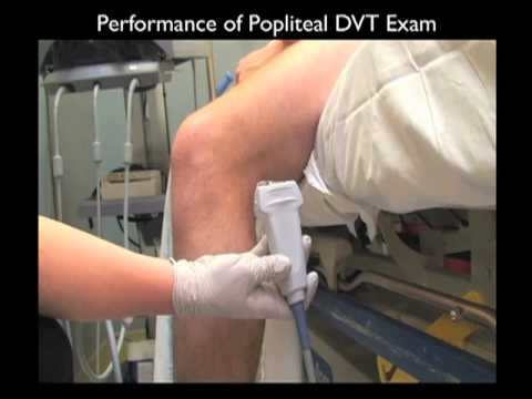 how to perform dvt ultrasound