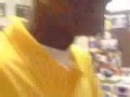 Soulja Boy Got A Hella Pimple On His Face!