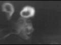 Intense smoke ring action