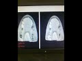 prosthodontist khaled entabi ????? ??????? prosthodontist khaled entabi ????? ???????