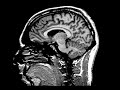 MRI scan1 MRI scan1