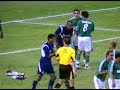 Pênalti ridículo - Anderson Lima