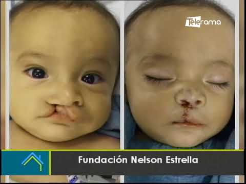 Fundación Nelson Estrella