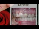 LVI Smile Cosmetic Dentists 5 LVI Smile Cosmetic Dentists 5