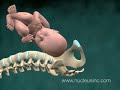 Animación Médica de 3D sobre el Distocia del Hombro Herido e