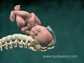 Animación Médica de 3D sobre el Distocia del Hombro Herido e