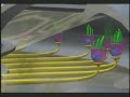 cochlear implant deaf hearing