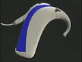 Cochlear Implant