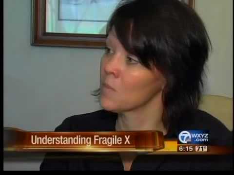 how to test for fragile x syndrome