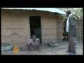 Somali-lepers-stigma