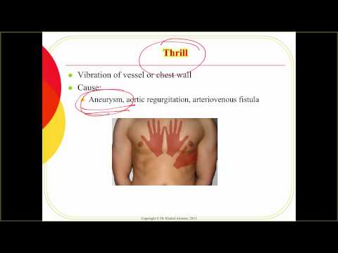 how to assess pitting edema