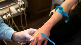 How to Start an IV (sample Video)